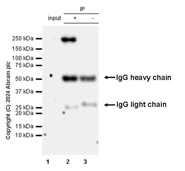 Immunoprecipitation - Anti-SMCHD1 antibody [EPR27952-42] (AB317811)