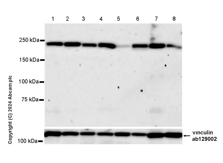 Western blot - Anti-SMCHD1 antibody [EPR27952-42] (AB317811)