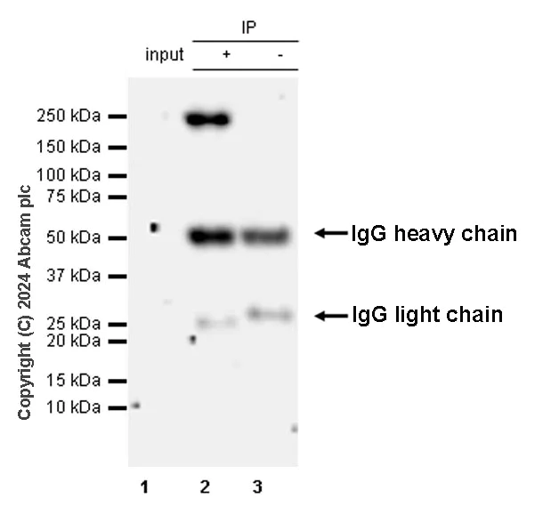 Immunoprecipitation - Anti-SMCHD1 antibody [EPR27952-42] - BSA and Azide free (AB317812)