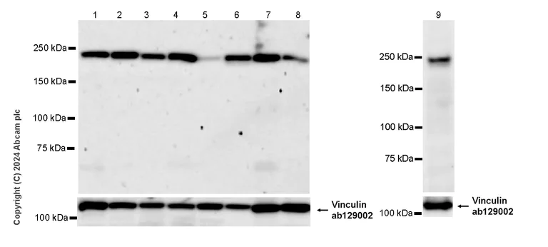 Western blot - Anti-SMCHD1 antibody [EPR27952-42] - BSA and Azide free (AB317812)