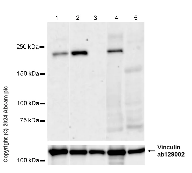 Western blot - Anti-SMCHD1 antibody [EPR27952-42] - BSA and Azide free (AB317812)