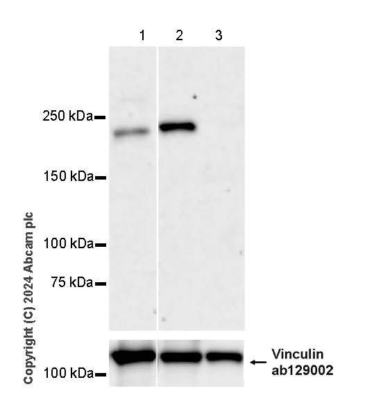 Western blot - Anti-SMCHD1 antibody [EPR27952-42] - BSA and Azide free (AB317812)