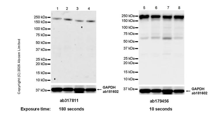 Western blot - Anti-SMCHD1 antibody [EPR27952-42] - BSA and Azide free (AB317812)