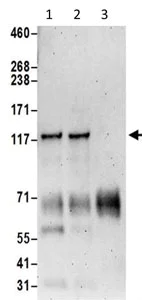 Immunoprecipitation - Anti-SMCR8 antibody (AB202283)