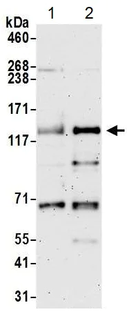 Western blot - Anti-SMCR8 antibody (AB202283)