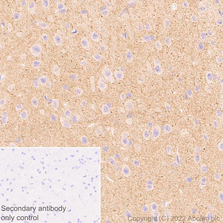 Immunohistochemistry (Formalin/PFA-fixed paraffin-embedded sections) - Anti-SMCR8 antibody [EPR26215-5] - BSA and Azide free (AB303549)