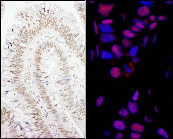 Immunohistochemistry (Formalin/PFA-fixed paraffin-embedded sections) - Anti-Smek1 antibody (AB70635)