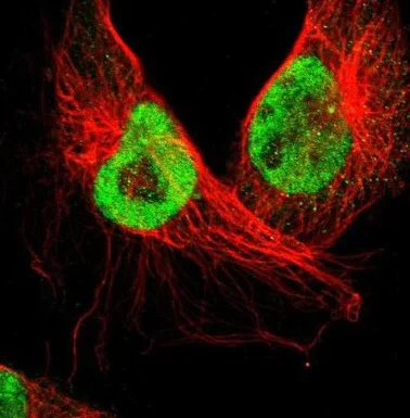 Immunocytochemistry/ Immunofluorescence - Anti-SMEK2 antibody (AB224222)