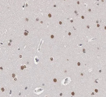 Immunohistochemistry (Formalin/PFA-fixed paraffin-embedded sections) - Anti-SMEK2 antibody (AB224222)