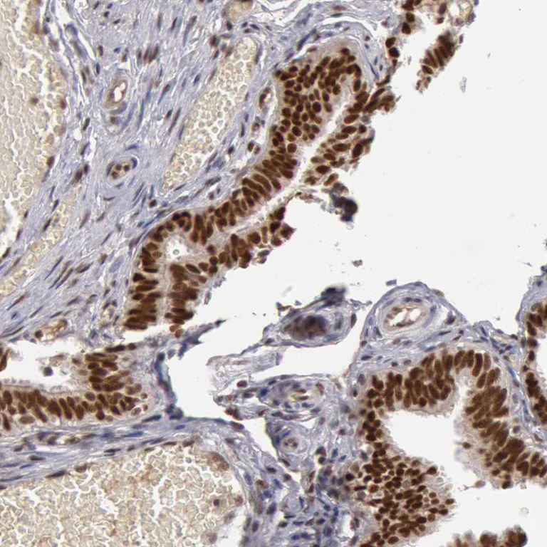 Immunohistochemistry (Formalin/PFA-fixed paraffin-embedded sections) - Anti-SMEK2 antibody (AB224222)