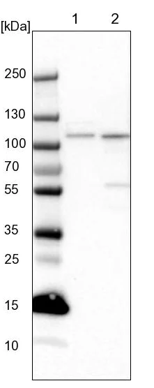 Western blot - Anti-SMEK2 antibody (AB224222)
