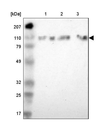 Western blot - Anti-SMEK2 antibody (AB224222)