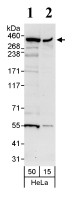 Western blot - Anti-Smg1 antibody (AB80600)