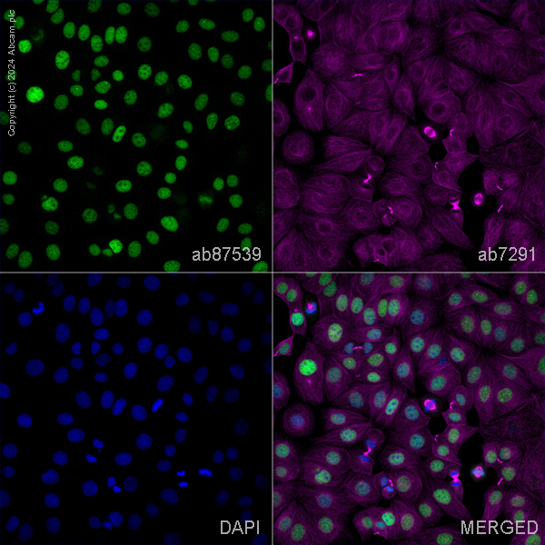 Immunocytochemistry/ Immunofluorescence - Anti-SMG6 antibody (AB87539)