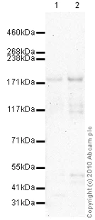 Western blot - Anti-SMG6 antibody (AB87539)