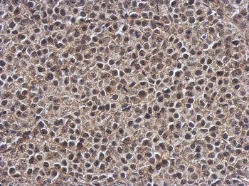Immunohistochemistry (Formalin/PFA-fixed paraffin-embedded sections) - Anti-SMG7 antibody (AB126984), expandable thumbnail