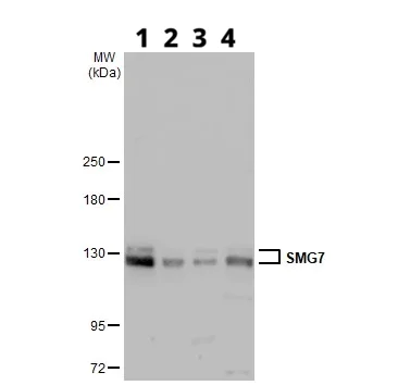 Western blot - Anti-SMG7 antibody (AB126984)