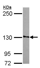 Western blot - Anti-SMG7 antibody (AB126984), expandable thumbnail