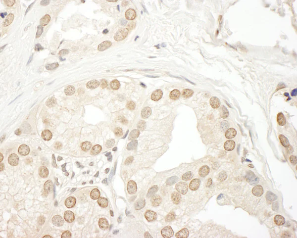 Immunohistochemistry (Formalin/PFA-fixed paraffin-embedded sections) - Anti-SMG9 antibody (AB85659)