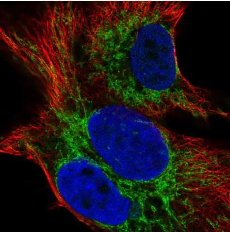 Immunocytochemistry/ Immunofluorescence - Anti-SMIM12 antibody (AB204555)