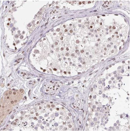 Immunohistochemistry (Formalin/PFA-fixed paraffin-embedded sections) - Anti-SMIM12 antibody (AB204555)