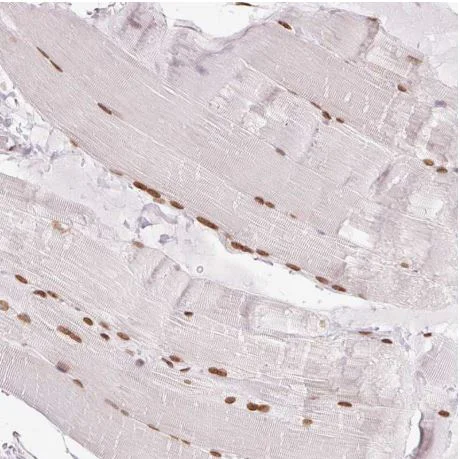 Immunohistochemistry (Formalin/PFA-fixed paraffin-embedded sections) - Anti-SMIM12 antibody (AB204555)