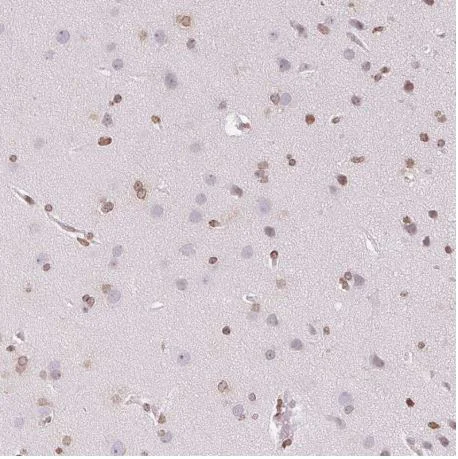 Immunohistochemistry (Formalin/PFA-fixed paraffin-embedded sections) - Anti-SMIM12 antibody (AB204555)