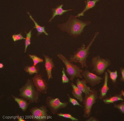 Immunocytochemistry/ Immunofluorescence - Anti-SMN/Gemin 1 antibody [2B1] (AB5831)