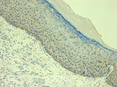 Immunohistochemistry (Formalin/PFA-fixed paraffin-embedded sections) - Anti-SMN/Gemin 1 antibody [2B1] (AB5831)