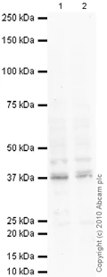 Western blot - Anti-SMN/Gemin 1 antibody [2B1] (AB5831)