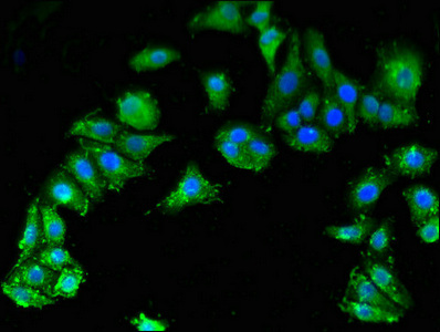 Immunocytochemistry/ Immunofluorescence - Anti-SMN/Gemin 1 antibody (AB223068), expandable thumbnail