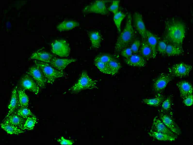 Immunocytochemistry/ Immunofluorescence - Anti-SMN/Gemin 1 antibody (AB223068)