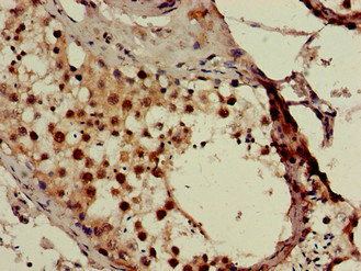 Immunohistochemistry (Formalin/PFA-fixed paraffin-embedded sections) - Anti-SMN/Gemin 1 antibody (AB223068), expandable thumbnail