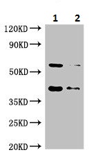 Western blot - Anti-SMN/Gemin 1 antibody (AB223068), expandable thumbnail