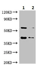 Western blot - Anti-SMN/Gemin 1 antibody (AB223068)