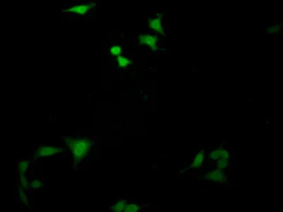 Immunocytochemistry/ Immunofluorescence - Anti-SMN/Gemin 1 antibody (AB232784)