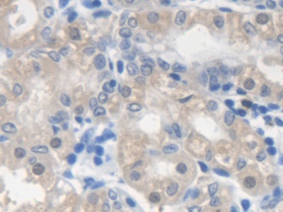 Immunohistochemistry (Formalin/PFA-fixed paraffin-embedded sections) - Anti-SMN/Gemin 1 antibody (AB232784)