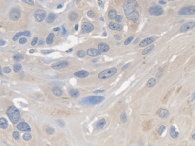 Immunohistochemistry (Formalin/PFA-fixed paraffin-embedded sections) - Anti-SMN/Gemin 1 antibody (AB232784)