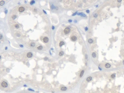 Immunohistochemistry (Formalin/PFA-fixed paraffin-embedded sections) - Anti-SMN/Gemin 1 antibody (AB232784)
