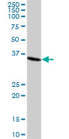 Western blot - Anti-SMN/Gemin 1 antibody (AB88979)
