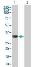 Western blot - Anti-SMN/Gemin 1 antibody (AB88979)