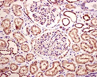 Immunohistochemistry (Formalin/PFA-fixed paraffin-embedded sections) - Anti-SMN/Gemin 1 antibody [EPR4430] - BSA and Azide free (AB247668)