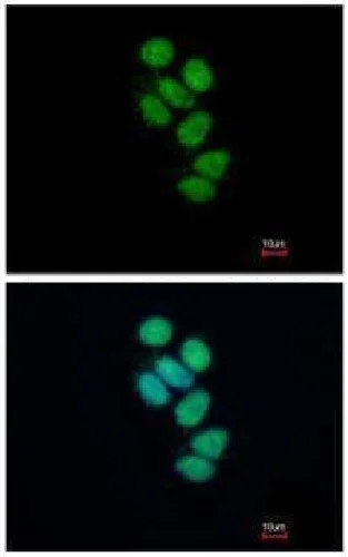 Immunocytochemistry/ Immunofluorescence - Anti-SMNDC1 antibody (AB227952)