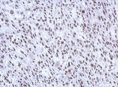 Immunohistochemistry (Formalin/PFA-fixed paraffin-embedded sections) - Anti-SMNDC1 antibody (AB227952)