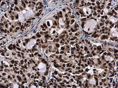 Immunohistochemistry (Formalin/PFA-fixed paraffin-embedded sections) - Anti-SMNDC1 antibody (AB227952)
