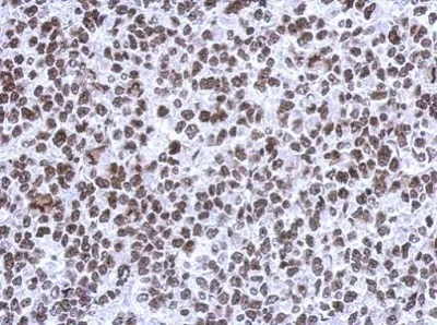 Immunohistochemistry (Formalin/PFA-fixed paraffin-embedded sections) - Anti-SMNDC1 antibody (AB227952)
