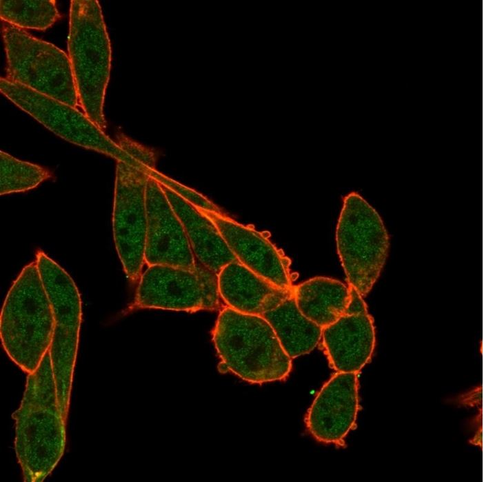 Immunocytochemistry - Anti-SMNDC1 antibody [PCRP-SMNDC1-1A9] (AB277099), expandable thumbnail