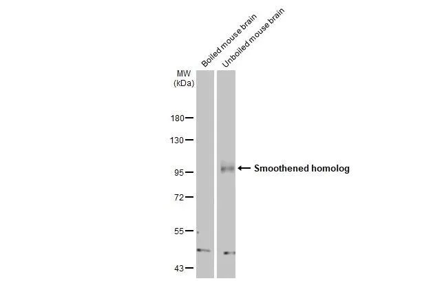 Western blot - Anti-SMO antibody [HL2975] - BSA and Azide free (AB325873)