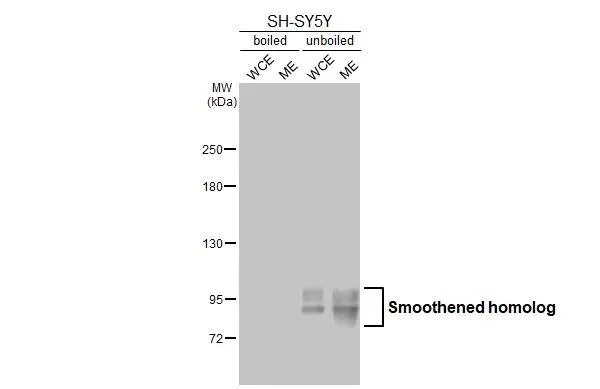 Western blot - Anti-SMO antibody [HL2975] - BSA and Azide free (AB325873)