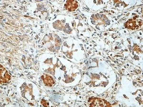 Immunohistochemistry (Formalin/PFA-fixed paraffin-embedded sections) - Anti-SMOC1 antibody (AB200219)
